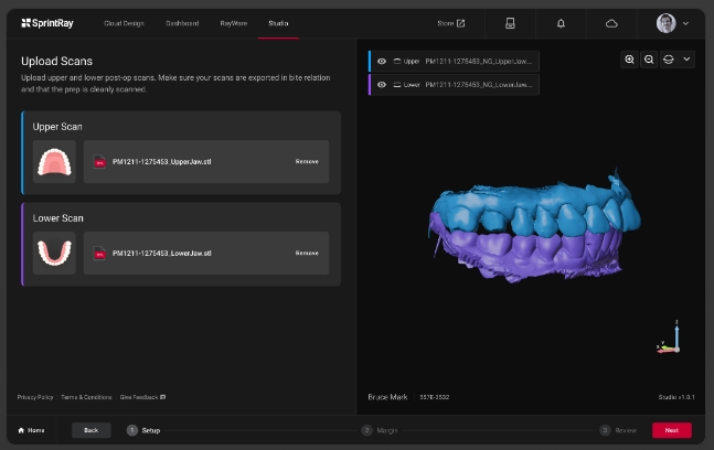[视频] SprintRay Midas：数字印刷立体光刻 (DPS) 牙科3D制造的巨大飞跃