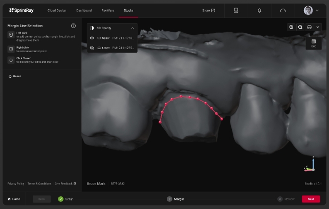 [视频] SprintRay Midas：数字印刷立体光刻 (DPS) 牙科3D制造的巨大飞跃