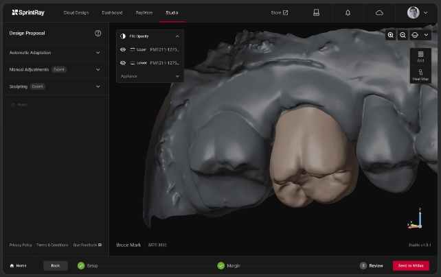 [视频] SprintRay Midas：数字印刷立体光刻 (DPS) 牙科3D制造的巨大飞跃